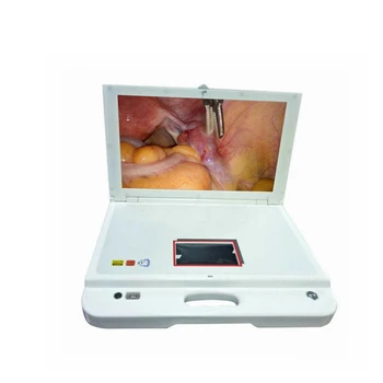 medicīnisko ierīču laparoskopijas komplekts par hysteroscopy artroskopija UZŅ 0
